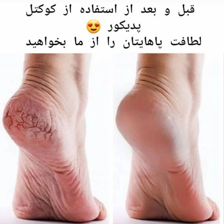 کوکتل پدیکور پا /70 گرم
