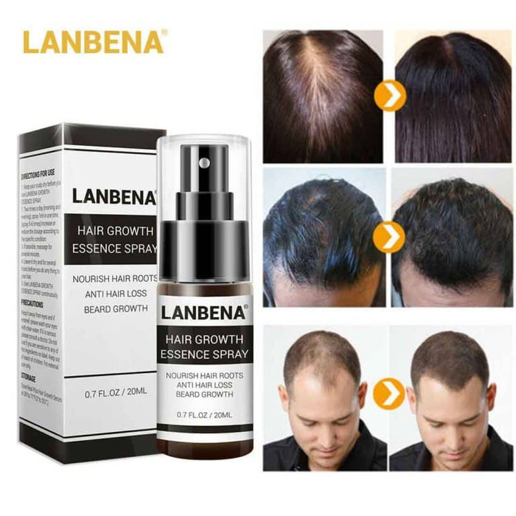 اسپری تقویت رشد مو لانبنا ضدریزش مو Lanbena Hair Growth Essential Spray